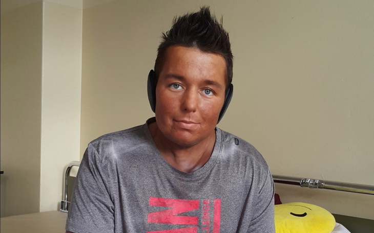 Młody mężczyzna z problemami zdrowotnymi w szarej koszulce.