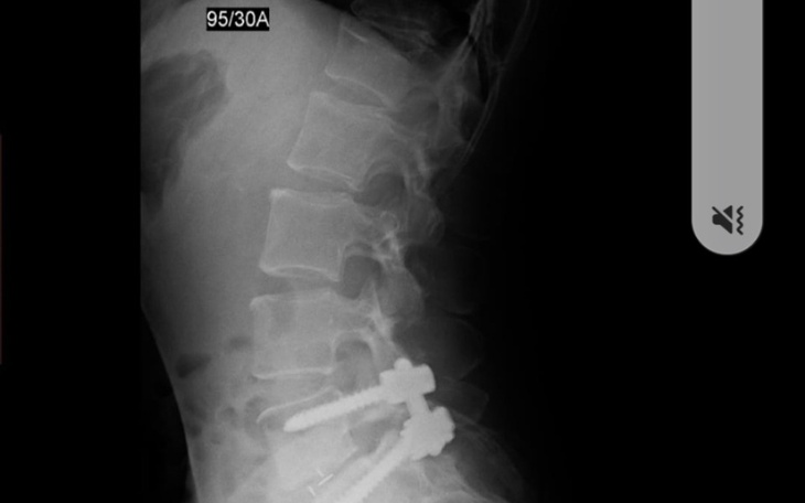 Zbiórka Chemioterapia I rehabilitacja - zdjęcie główne