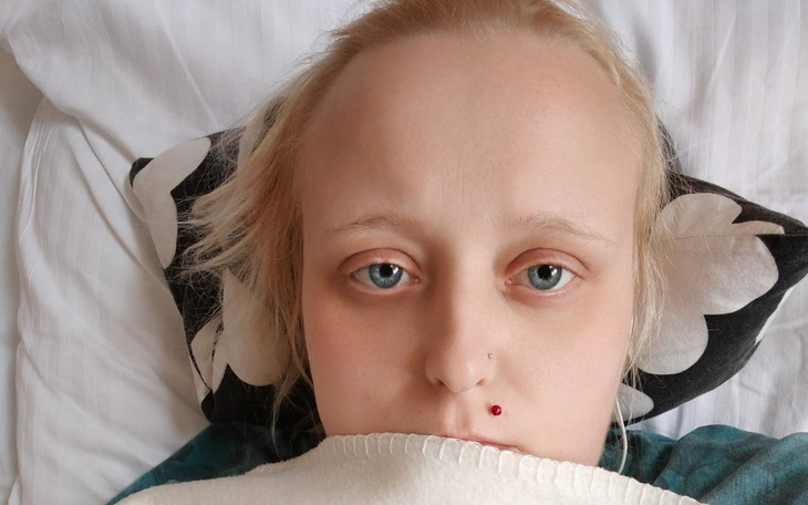 Zbiórka Proszę o pomoc z walka chorob - zdjęcie główne