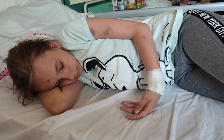 Dziewczynka śpiąca na łóżku z opatrunkiem na ręce.