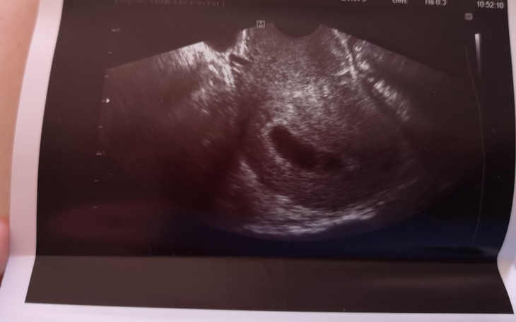 Zbiórka Na wyprawkę dla mojego maluszka - zdjęcie główne