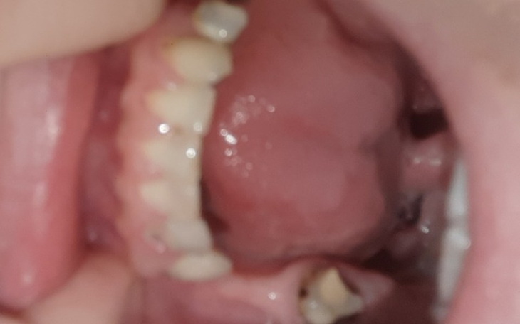 Zbiórka Drugi uśmiech - zdjęcie główne