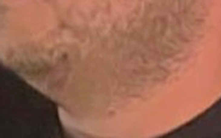 Zbiórka Usunięcie zlewu - zdjęcie główne