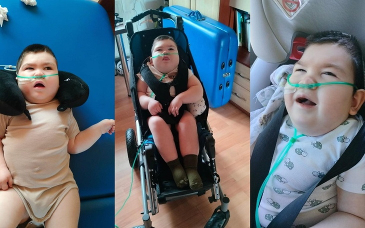 Zbiórka Wpłać grosza dla Miłosza - zdjęcie główne