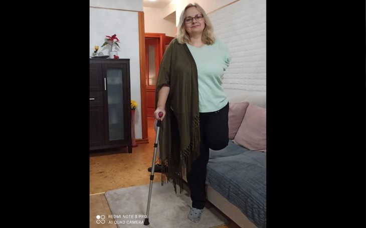 Zbiórka Joanna zbiórka na protezę nogi - zdjęcie główne