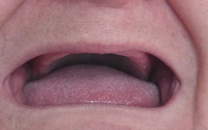 Otwarte usta osoby, widoczny język.