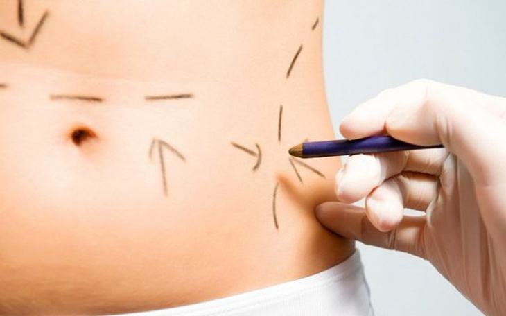 Zbiórka Ładna sylwetka - zdjęcie główne