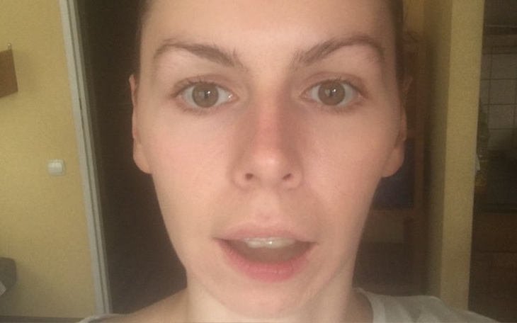 Zbiórka Wesprzyjmy Magdę - zdjęcie główne