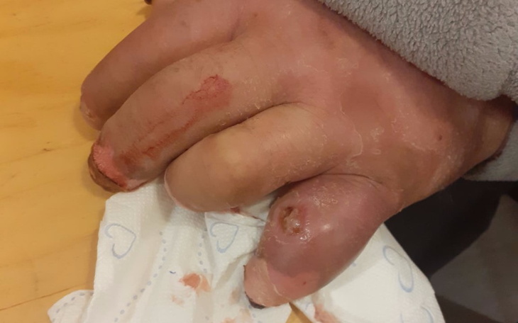 Zbiórka Na ratunek Zupie na Głównym - zdjęcie główne