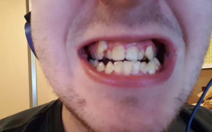 Zbiórka Czemu inni mogą a ja nie? - zdjęcie główne