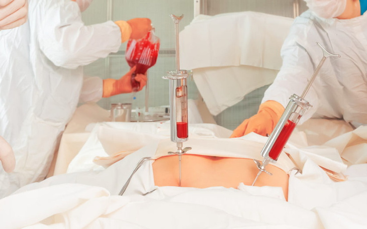 Zbiórka Na Leki,Wyprawkę na Przeszczep - zdjęcie główne