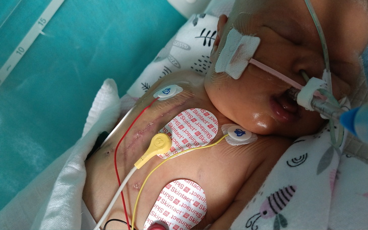 Noworodek w szpitalu z monitorami medycznymi.