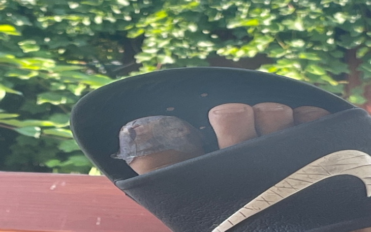 Zbiórka Zbieramy na chorego majkela. - zdjęcie główne