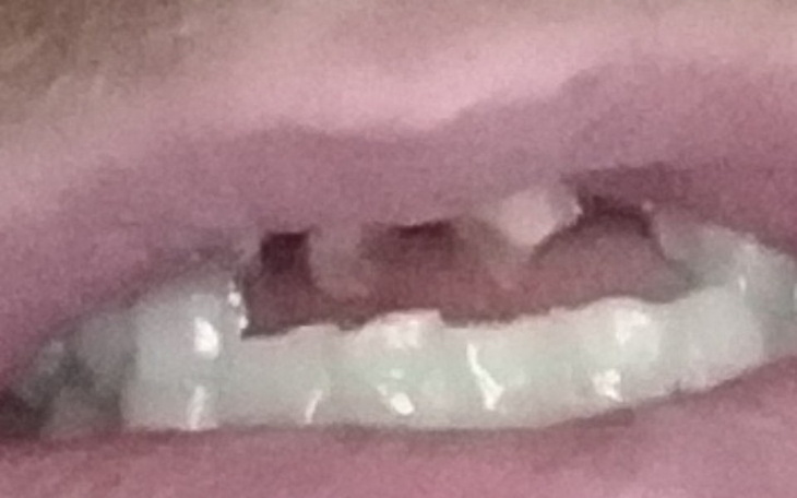 Zbiórka Leczenie uzębienia w narkozie - zdjęcie główne