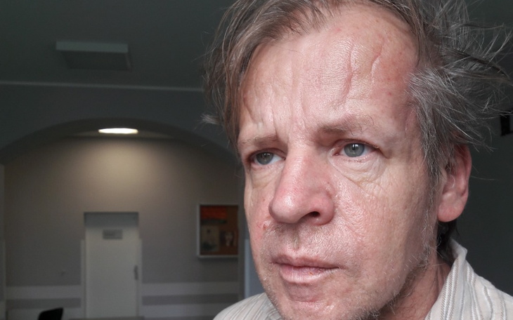 Zbiórka Leczenie meza chorego na autyzm - zdjęcie główne