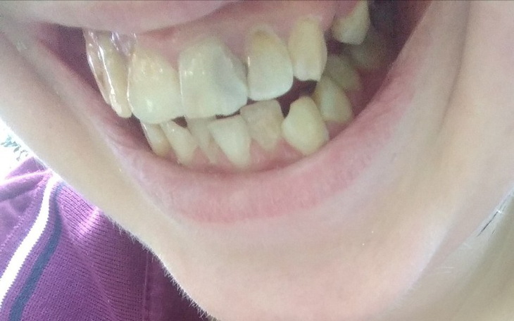 Zbiórka Leczenie zębów Katowice - zdjęcie główne