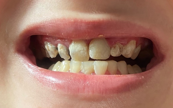 Zbiórka Zdrowy, wymarzony uśmiech - zdjęcie główne