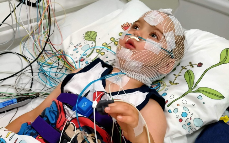 Małe dziecko z elektrodami na głowie w szpitalu.