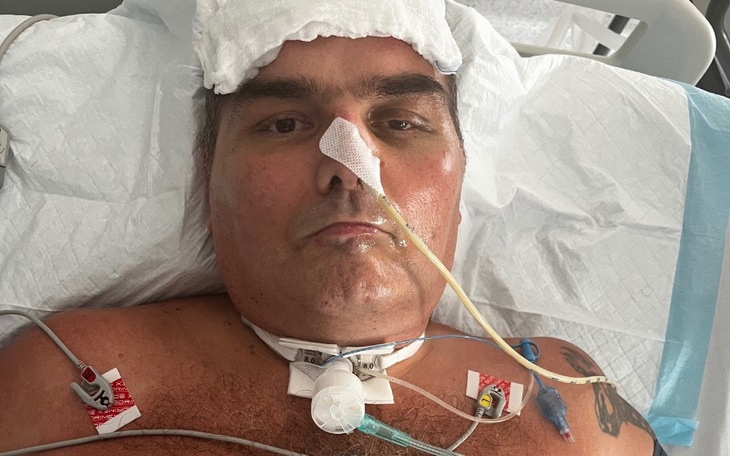 Mężczyzna leżący w szpitalu, z rurką tlenową i opatrunkami na ciele.