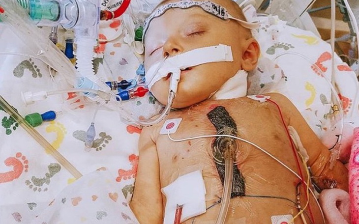 Zbiórka Leczenie TOF dla Julki - zdjęcie główne