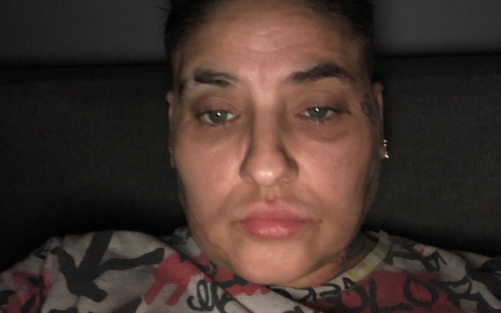 Zbiórka Zbiórka na leczenie i czynsz - zdjęcie główne