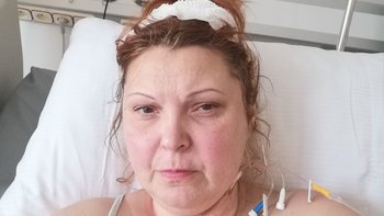 Zbiórka Oponiak mózgu - miniaturka zdjęcia