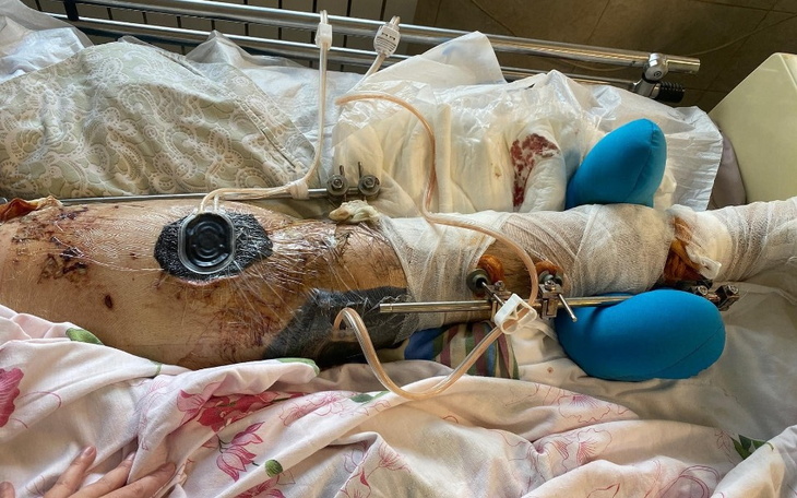 Zbiórka Pomoc w ogniu wojny w Ukrainie - zdjęcie główne