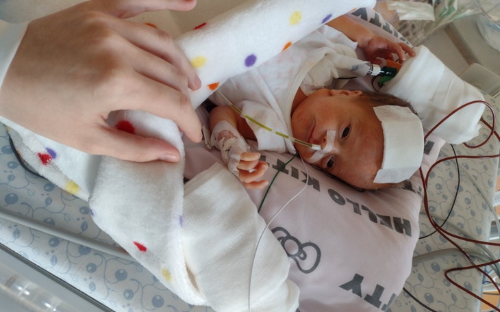 Zbiórka Na rehabilitacje Emilki - zdjęcie główne