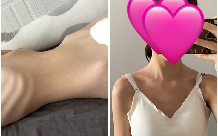 Zbiórka Odzyskanie radości z życia - zdjęcie główne