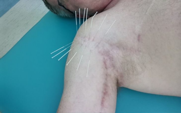 Zbiórka operacje i rehabilitację - zdjęcie główne