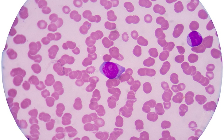 Zbiórka Pierwsza wizyta, transport. - zdjęcie główne