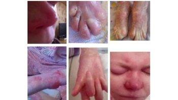 Zbiórka W skórze cierpienia - miniaturka zdjęcia