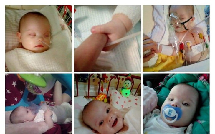 Zbiórka rehabilitacja Adrianny - zdjęcie główne