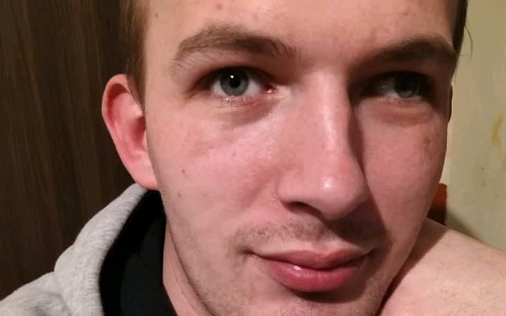 Pies patrzący w obiektyw, z ciekawym wyrazem twarzy.