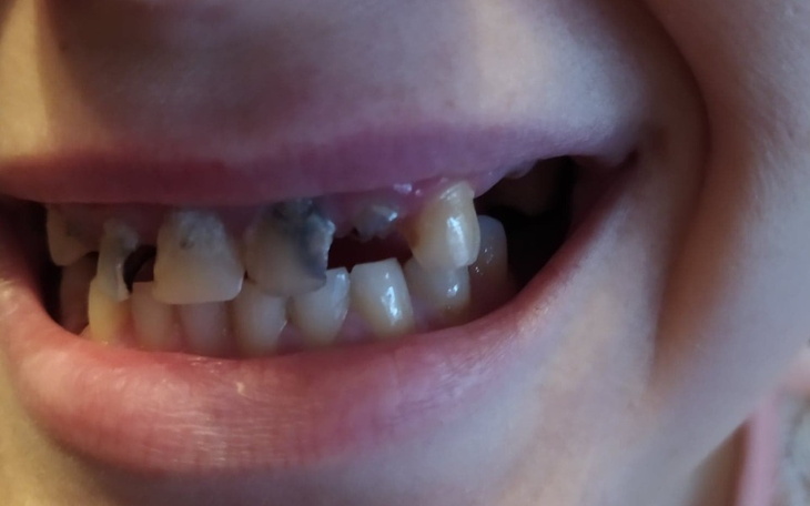 Zbiórka Uzębienie protezą - zdjęcie główne