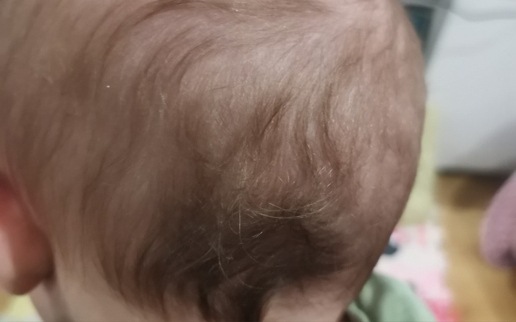 Zbiórka Kask korekcyjny dla córki - zdjęcie główne