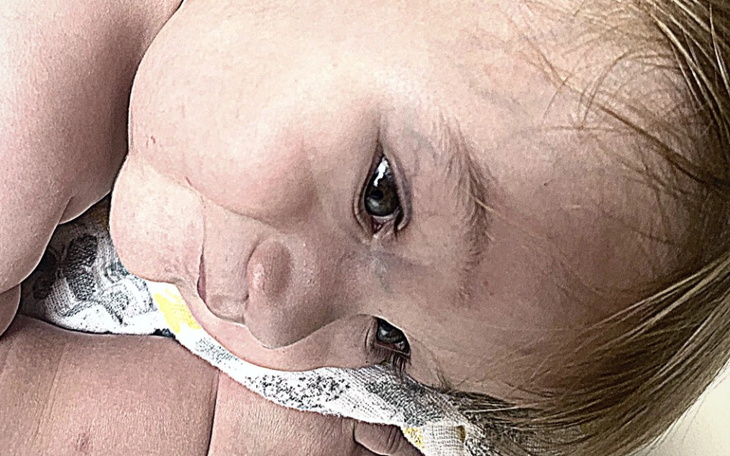 Zbiórka Serce Filipka woła o pomoc - zdjęcie główne