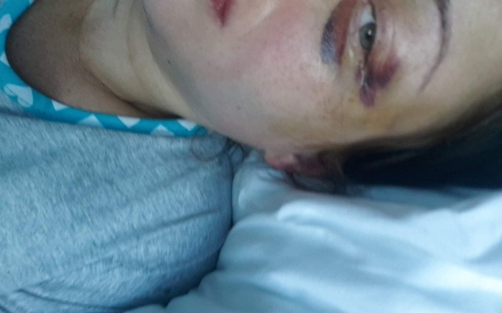 Zbiórka Proszę pomóż mi stanąć na nogi.. - zdjęcie główne