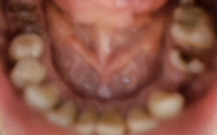 Zbliżenie na wnętrze ust, z widocznymi zębami.