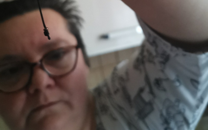 Zbiórka Rak przerzutami na węzły chlonne - zdjęcie główne