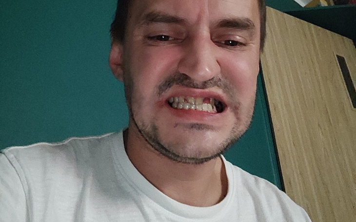 Zbiórka Na nowe ząbki, samotny tata - zdjęcie główne