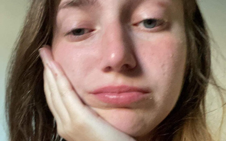 Młoda kobieta z wyrazem smutku na twarzy.