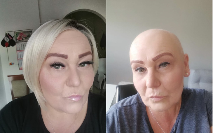 Zbiórka Leczenie i Rehabilitacja raka - zdjęcie główne