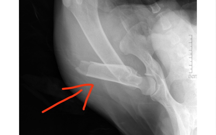 Zbiórka Miś z okropnym złamaniem łapy - zdjęcie główne