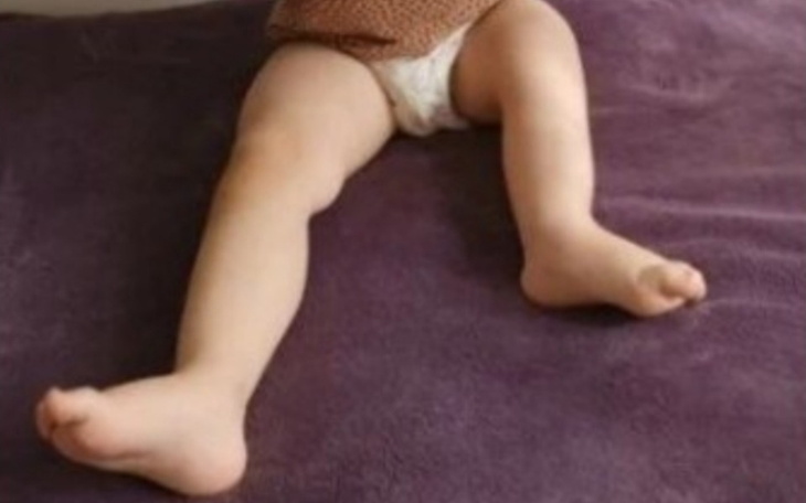 Zbiórka wydłużenia stawu lewej nogi - zdjęcie główne