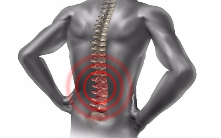 Zbiórka Leczenie raka kręgosłupa - zdjęcie główne