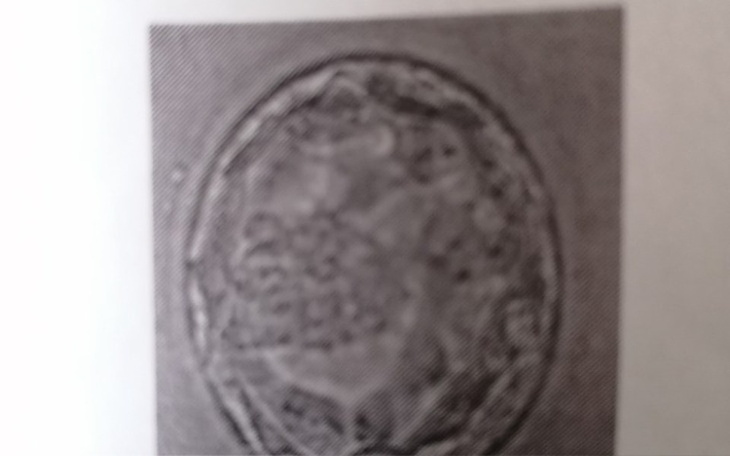 Zbiórka In Vitro ostatnia nadzieja - zdjęcie główne