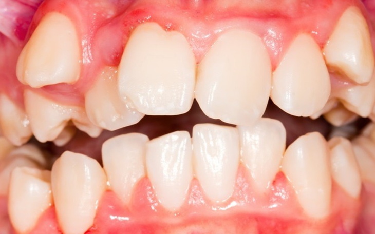 Zbliżenie na zęby zębów, zdrowe i białe.