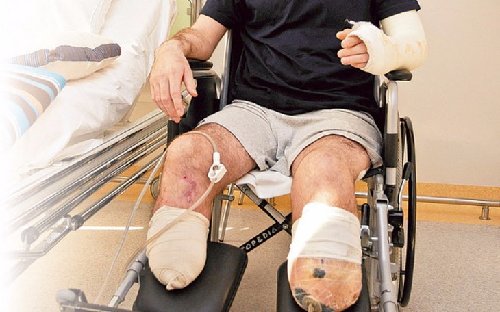 Zbiórka Proteza modularna dla Grześka! - zdjęcie główne