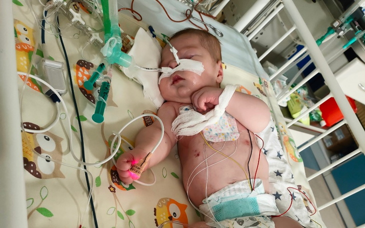 Małe dziecko w szpitalu, podłączone do aparatury medycznej.